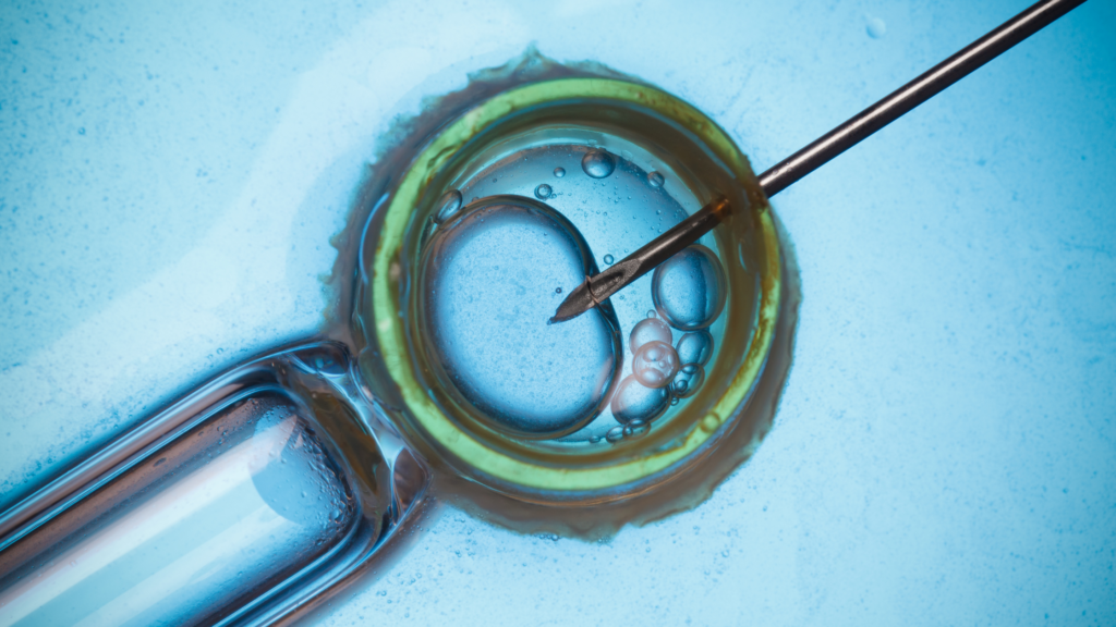 ivf procedure